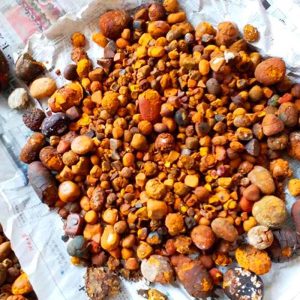 70% whole stones / 30% broken gallstones