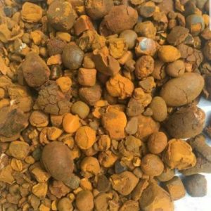 80% whole stones / 20% broken gallstones